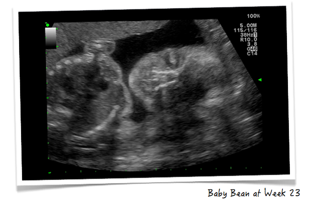 Baby Bump: Week 24 Pregnancy Update
